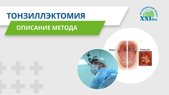Удаление миндалин: как проводится операция тонзиллэктомия